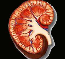 In Holguin more than 165 people have chronic renal failure In Holguin more than 165 people have chronic renal failure